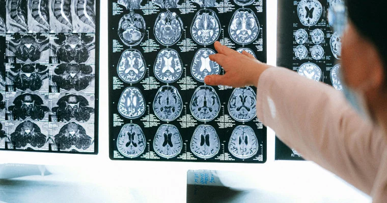 The Hidden System That Controls What You See